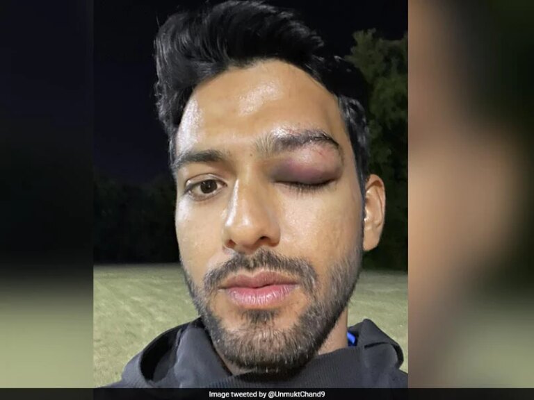 “Grateful To God To Have Survived A Possible Disaster”: Unmukt Chand Shares Pics Of Eye Injury | Cricket News